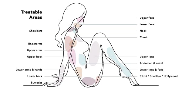 laser treatments